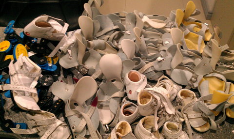 Dr Charlotte Hawkins In The Zanzibar Clubfoot Clinic